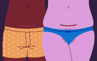 Navigating C-section Recovery with Ease