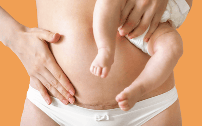 Self Massage & C-section Recovery