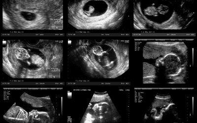 Ask A Doula: Sex Assigned at Birth Feels
