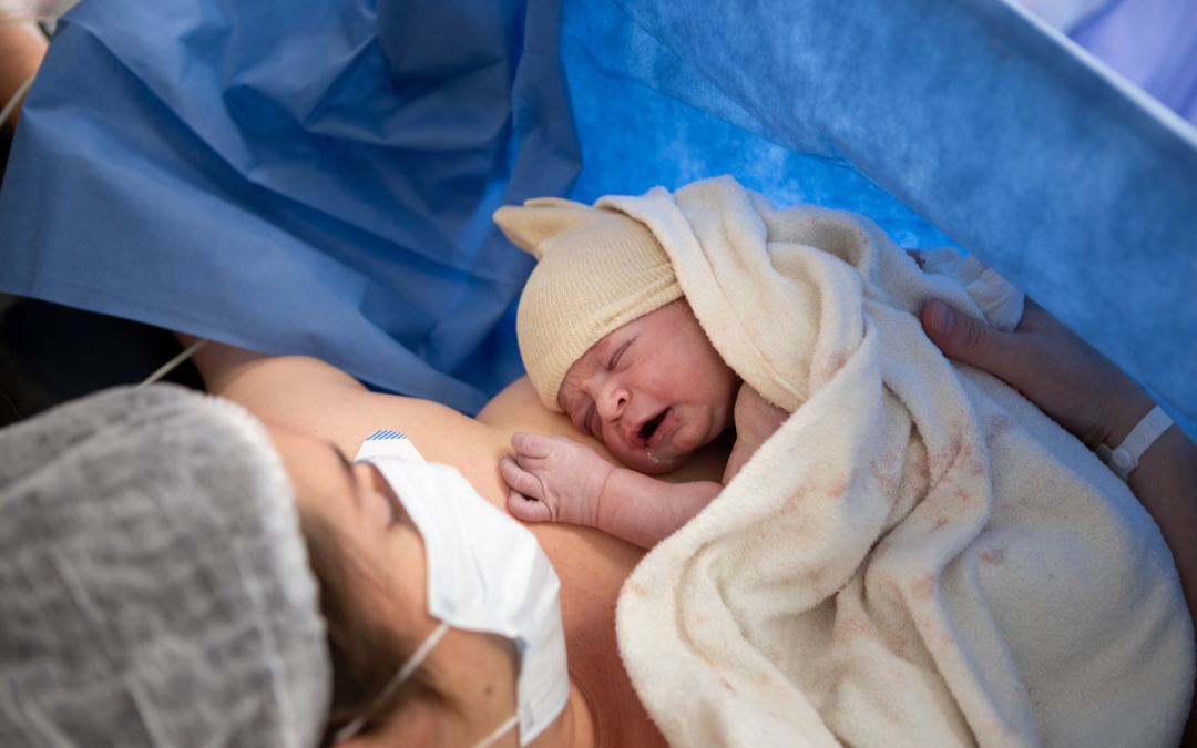 Yes, You Can Have a Doula at Your C-Section. Here’s Why It Matters.