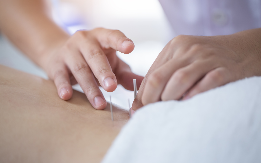 Acupuncture for Common Pregnancy Concerns: Gentle Support for Every Trimester 